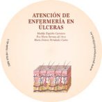 Atención de enfermería en Úlceras