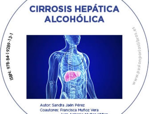 Cirrosis hepática alcohólica