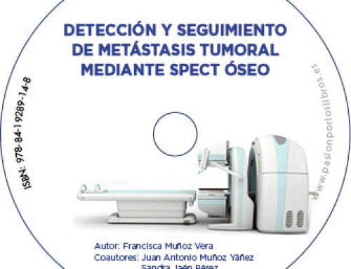 Detección y seguimiento de metástasis tumoral mediante SPECT óseo